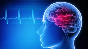 তরুণ বয়সেও কেন বাড়ছে স্ট্রোক? যেসব অভ্যাসে বাড়ে এর ঝুঁকি